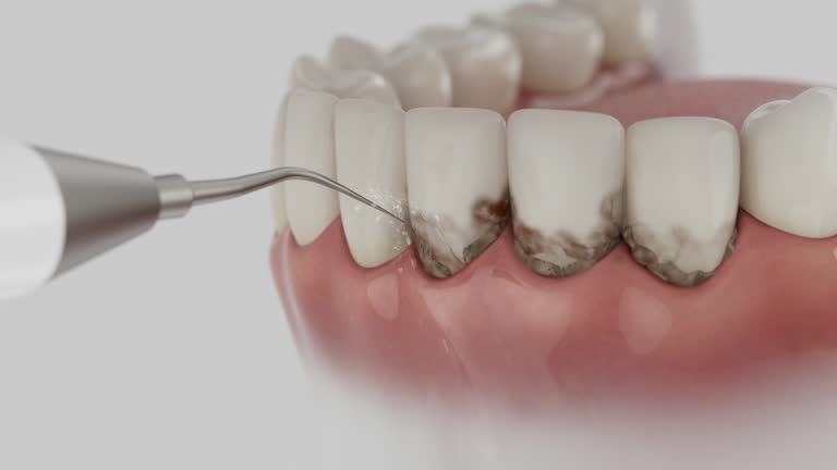 Trusted Wisdom Tooth Removal service in Corning, CA - Dentist Open Now